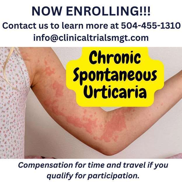 Chronic Spontaneous Urticaria – Clinical Trials Management